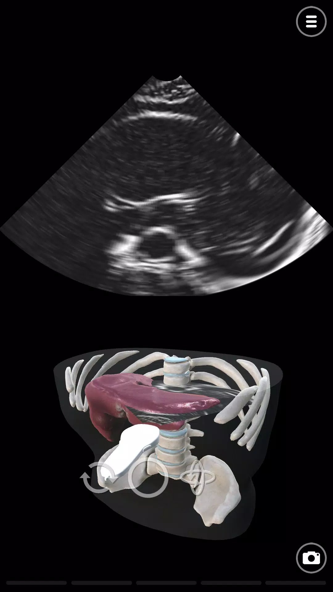 Deepscope Ultrasound Simulator應用截圖第1張