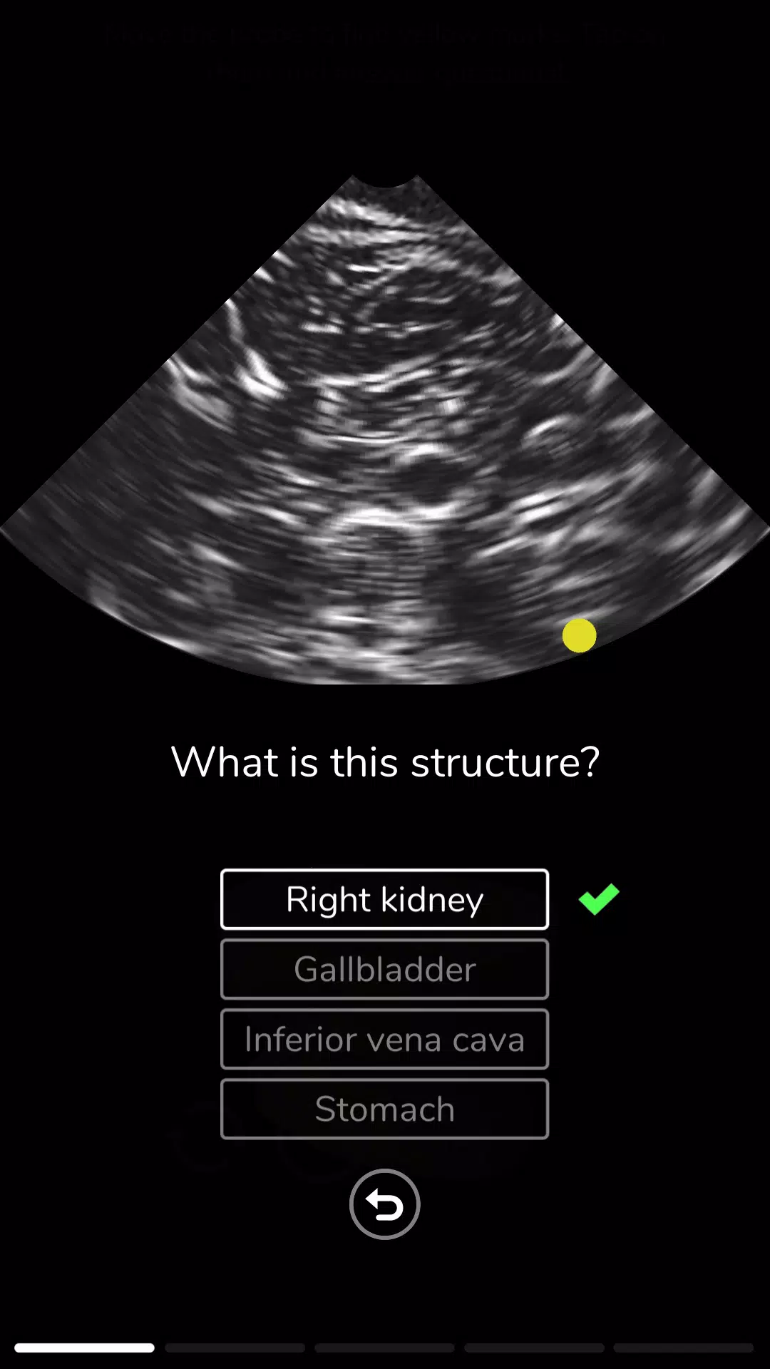 Deepscope Ultrasound Simulator應用截圖第3張